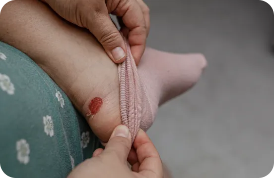 blisters-image-mobile.webp