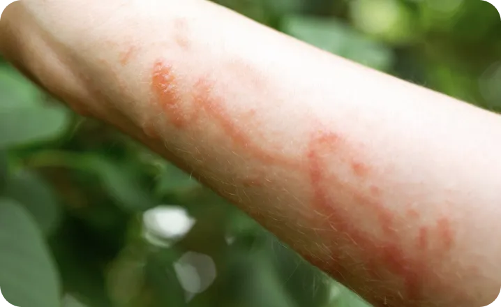 poison-ivy-image.webp